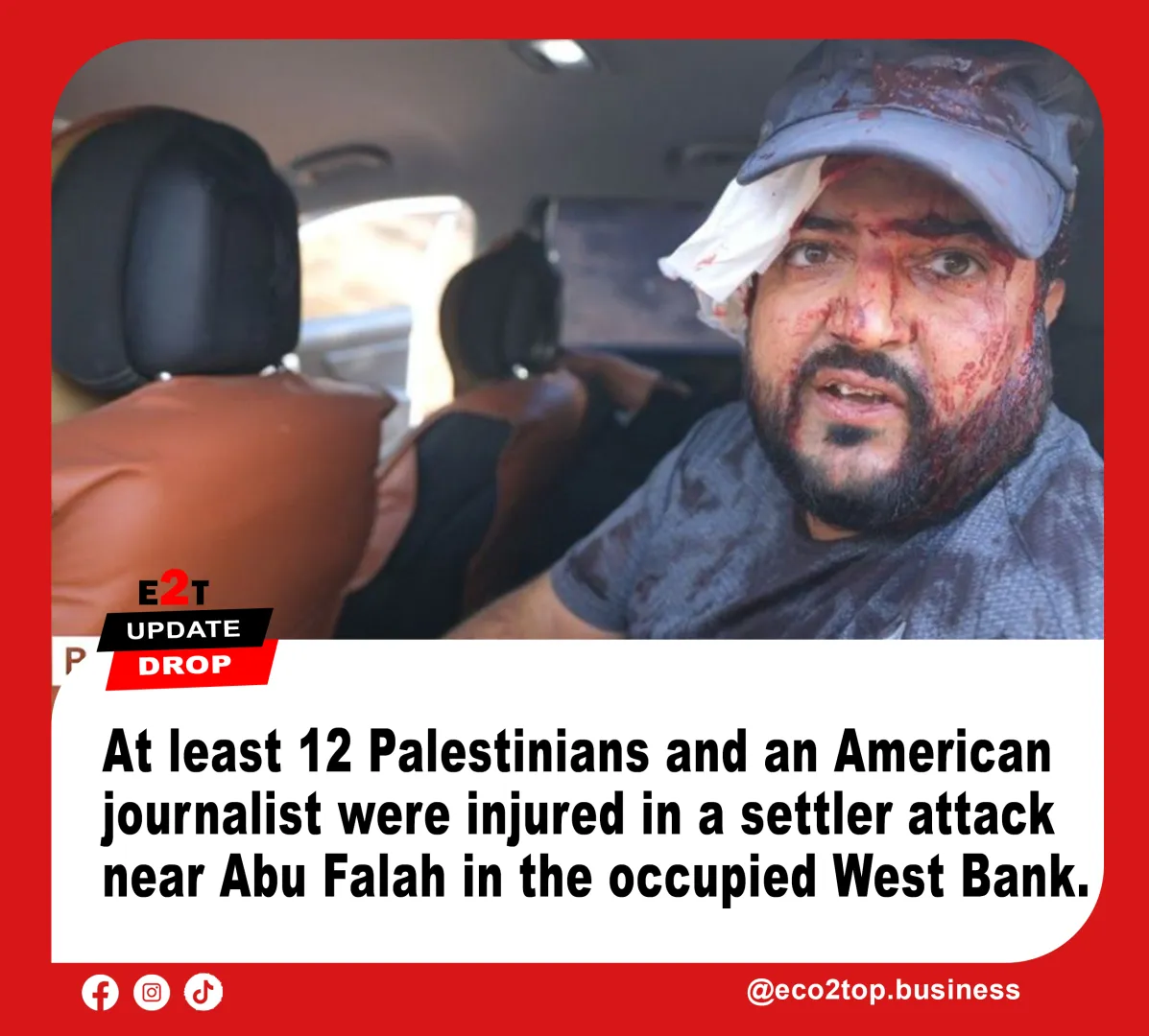 Palestinians and US Journalist Injured in Israeli Settler Attack During West Bank Olive Harvest